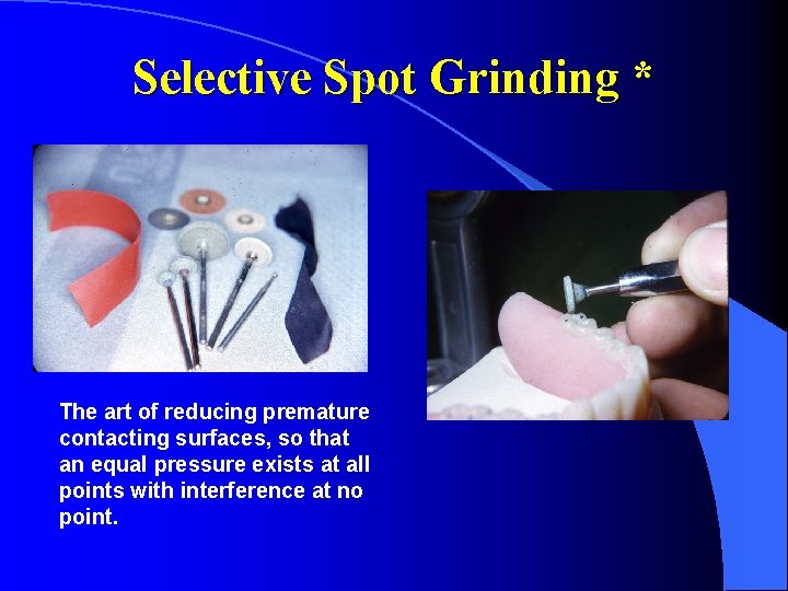 Selective Spot Grinding * The art of reducing premature contacting surfaces, so that an