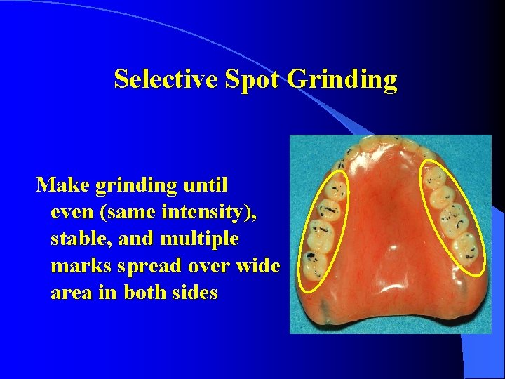 Selective Spot Grinding Make grinding until even (same intensity), stable, and multiple marks spread