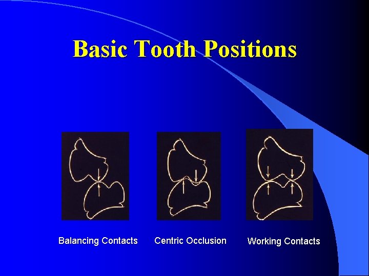 Basic Tooth Positions Balancing Contacts Centric Occlusion Working Contacts 