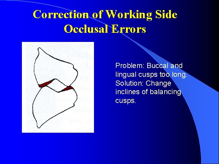 Correction of Working Side Occlusal Errors Problem: Buccal and lingual cusps too long. Solution: