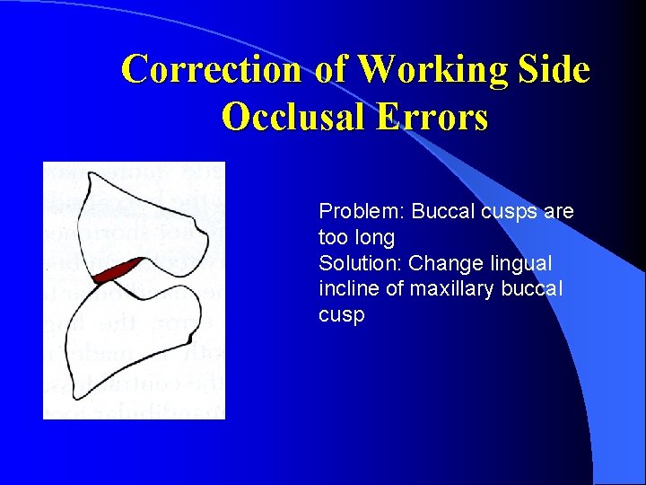 Correction of Working Side Occlusal Errors Problem: Buccal cusps are too long Solution: Change