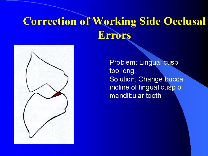 Correction of Working Side Occlusal Errors Problem: Lingual cusp too long. Solution: Change buccal