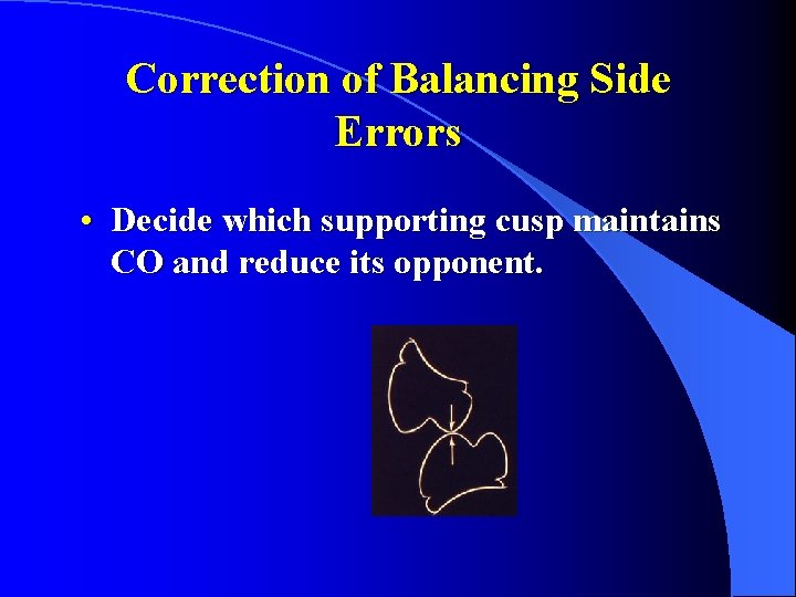 Correction of Balancing Side Errors • Decide which supporting cusp maintains CO and reduce