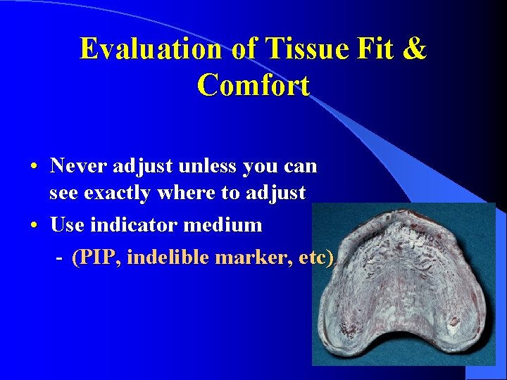 Evaluation of Tissue Fit & Comfort • Never adjust unless you can see exactly