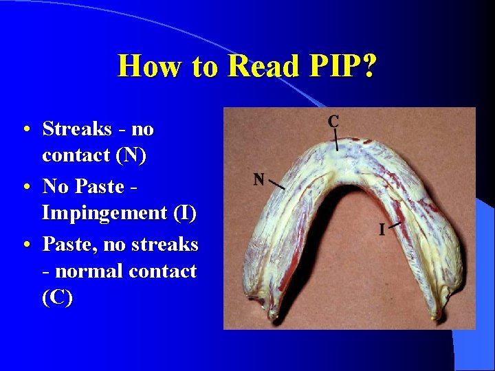 How to Read PIP? • Streaks - no contact (N) • No Paste Impingement