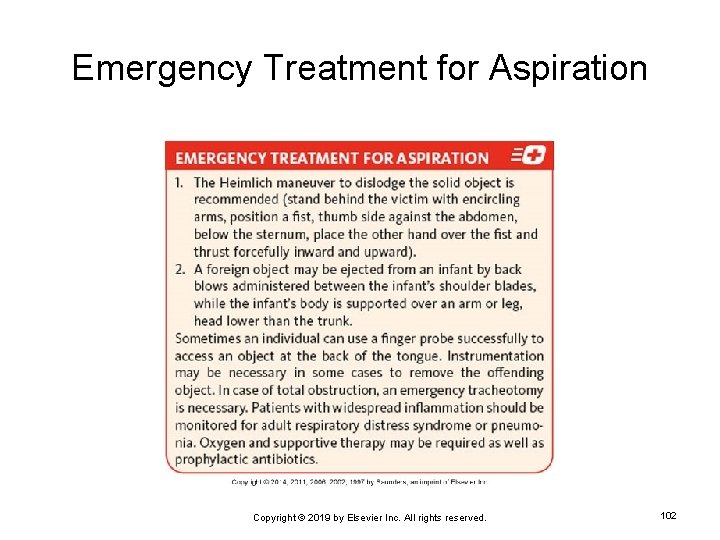 Emergency Treatment for Aspiration Copyright © 2019 by Elsevier Inc. All rights reserved. 102