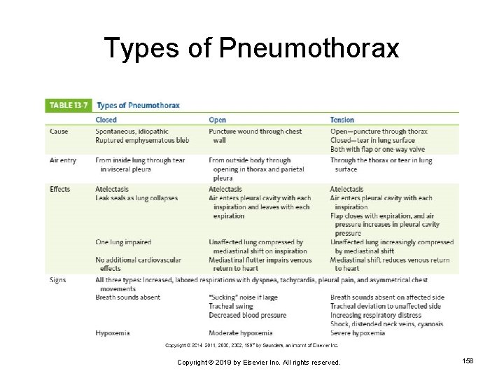 Types of Pneumothorax Copyright © 2019 by Elsevier Inc. All rights reserved. 158 