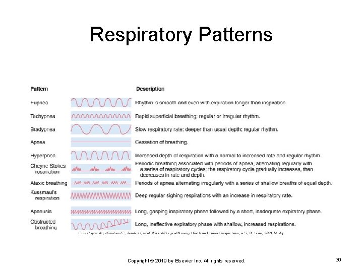 Respiratory Patterns Copyright © 2019 by Elsevier Inc. All rights reserved. 30 