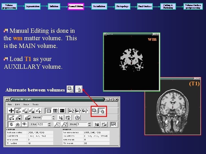 Volume preprocessing Segmentation Inflation Manual Editing is done in the wm matter volume. This