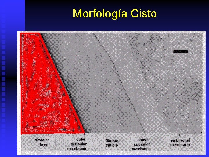 Morfología Cisto 