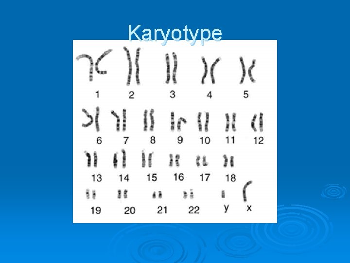 Karyotype 