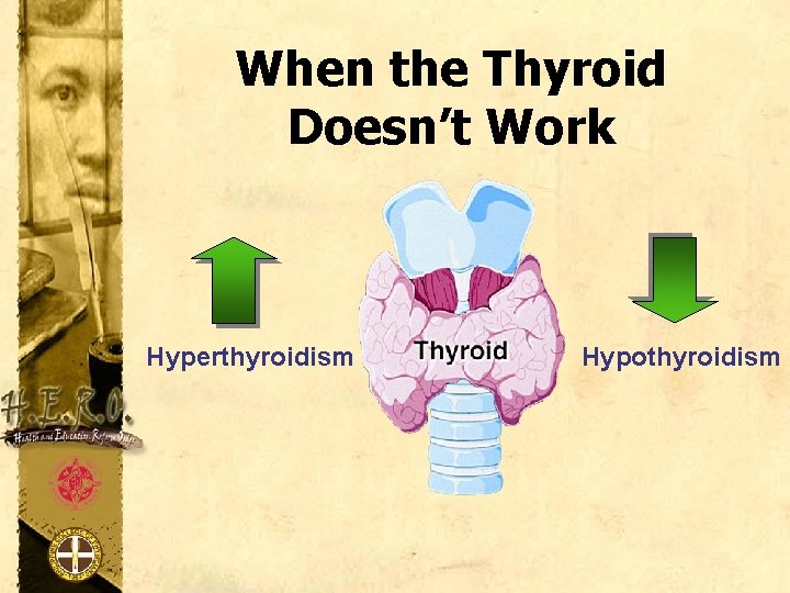 When the Thyroid Doesn’t Work Hyperthyroidism Hypothyroidism 