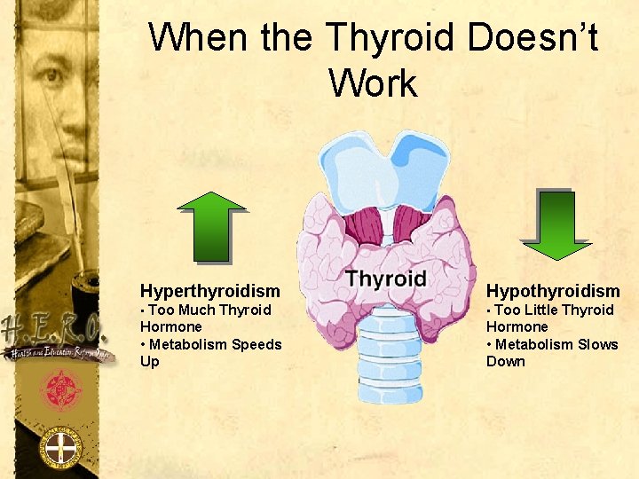 When the Thyroid Doesn’t Work Hyperthyroidism Hypothyroidism • Too Much Thyroid • Too Little