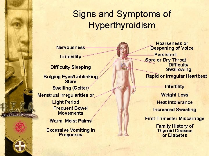 Signs and Symptoms of Hyperthyroidism Nervousness Irritability Difficulty Sleeping Bulging Eyes/Unblinking Stare Swelling (Goiter)