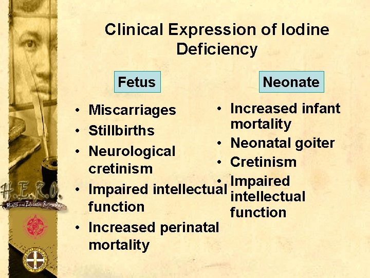 Clinical Expression of Iodine Deficiency Fetus Neonate • Increased infant • Miscarriages mortality •