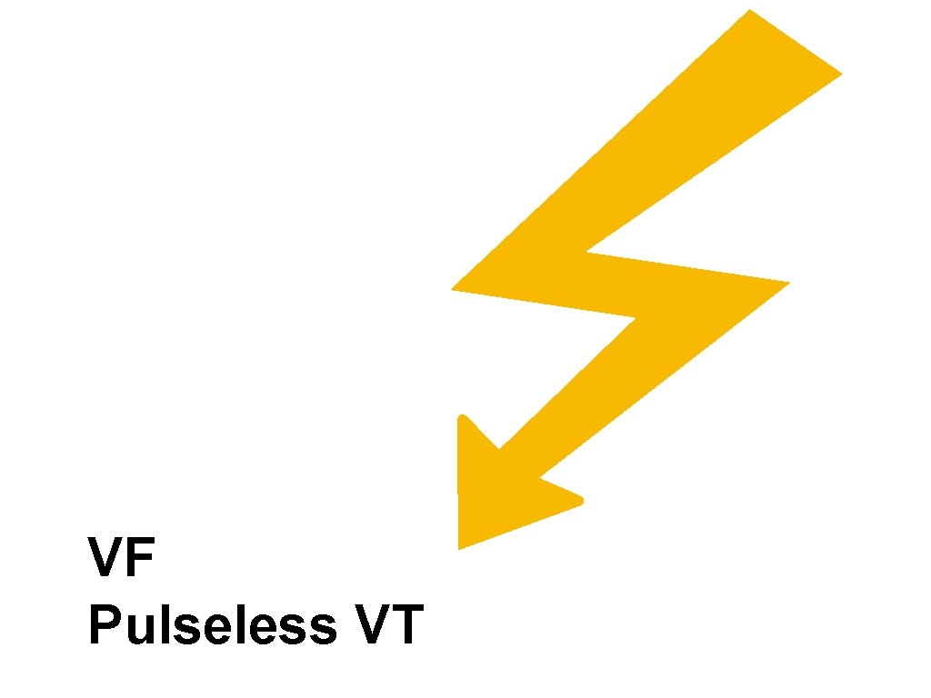 VF Pulseless VT 