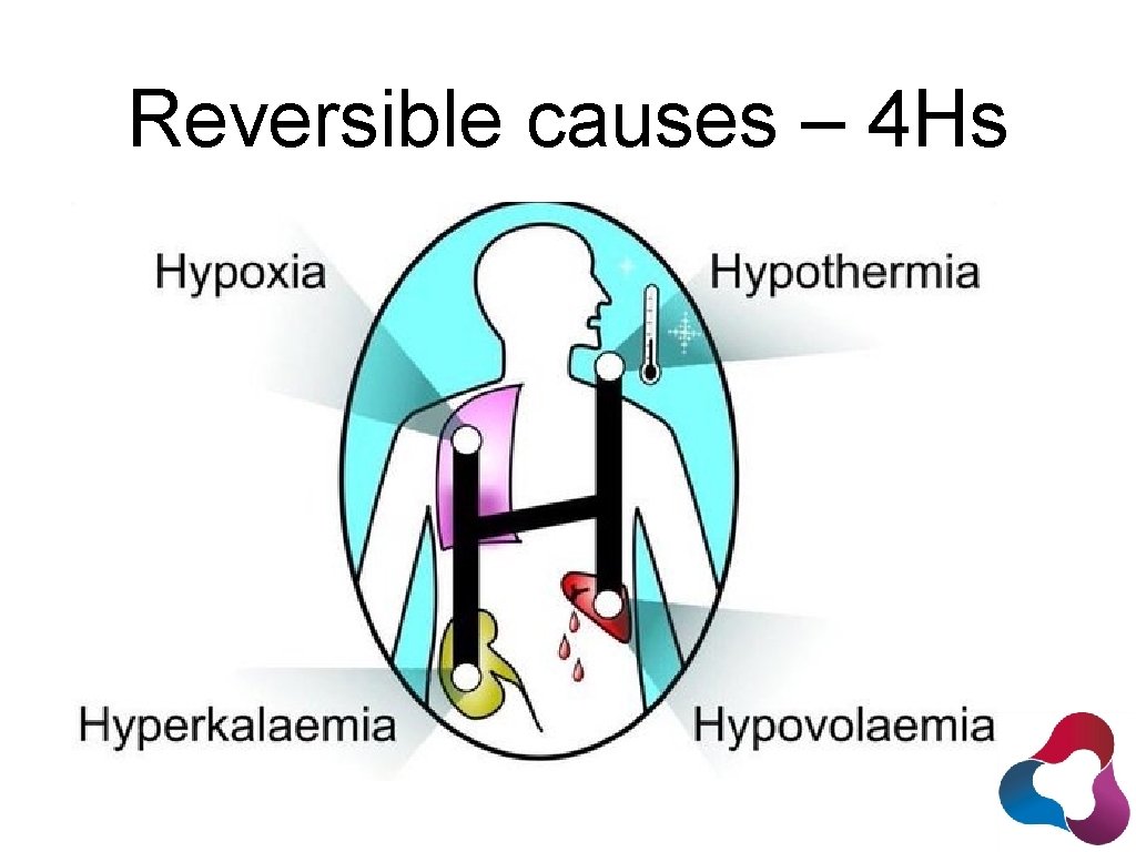 Reversible causes – 4 Hs 