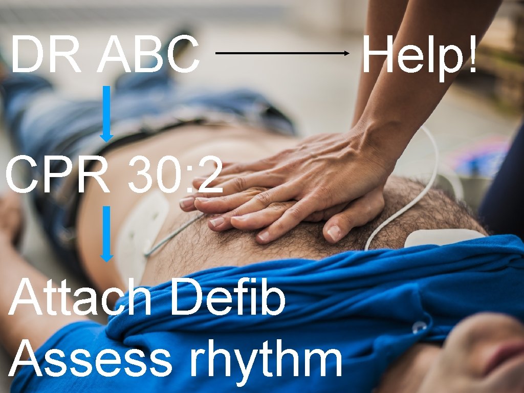 DR ABC CPR 30: 2 Attach Defib Assess rhythm Help! 