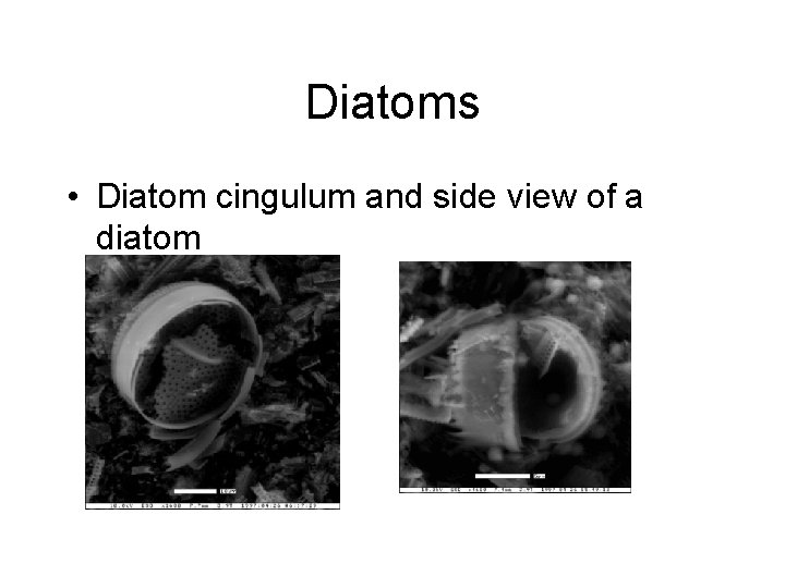 Diatoms • Diatom cingulum and side view of a diatom 