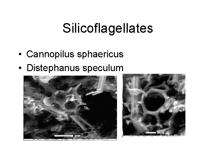 Silicoflagellates • Cannopilus sphaericus • Distephanus speculum 