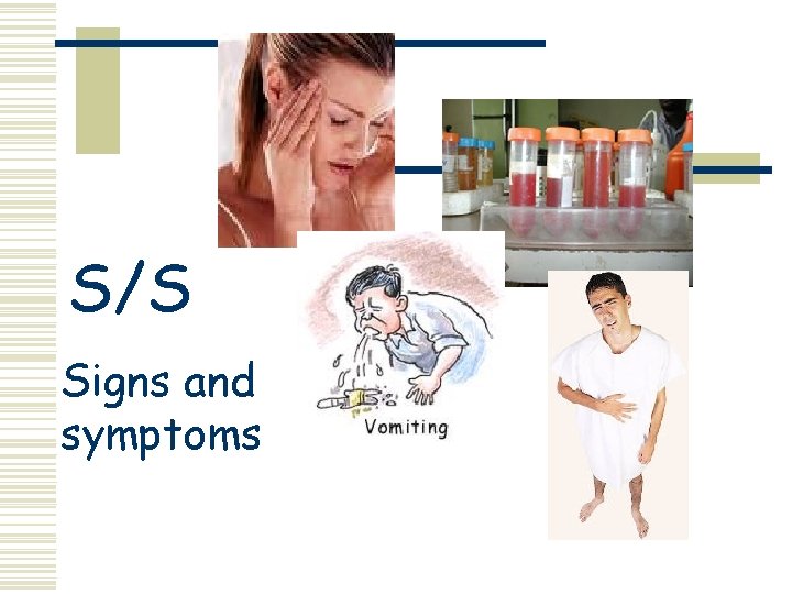 S/S Signs and symptoms 