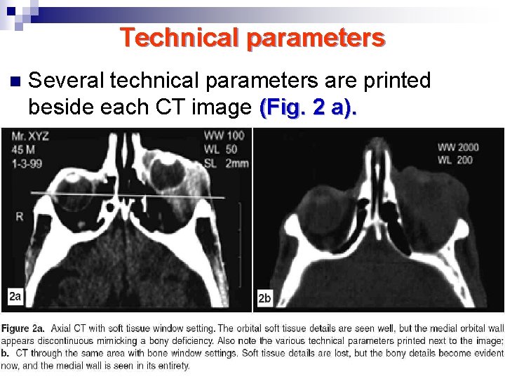Technical parameters n Several technical parameters are printed beside each CT image (Fig. 2