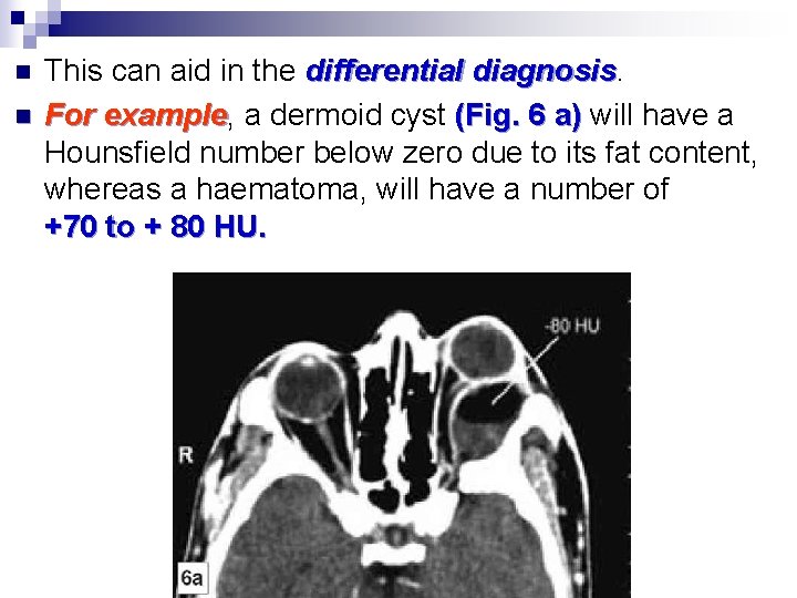 n n This can aid in the differential diagnosis For example, example a dermoid
