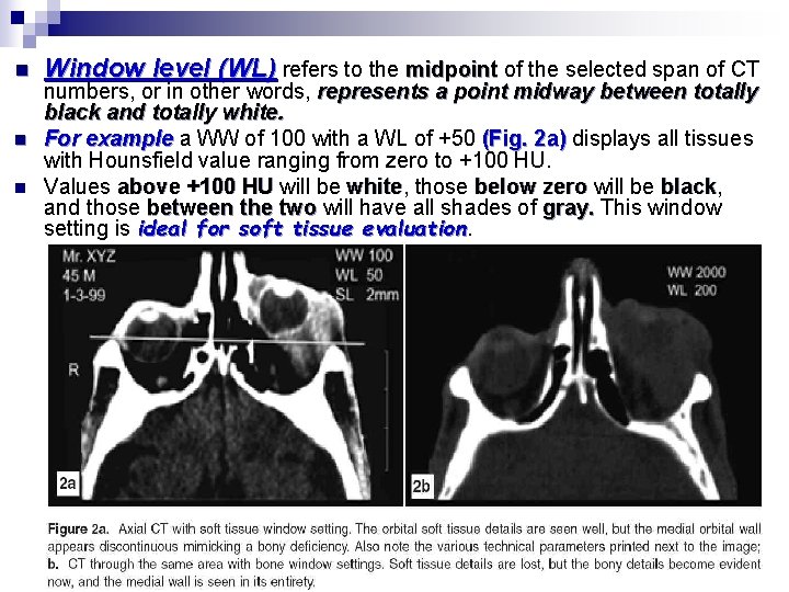 n n n Window level (WL) refers to the midpoint of the selected span