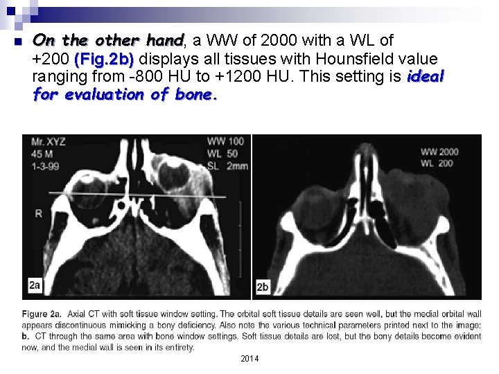 n On the other hand, hand a WW of 2000 with a WL of