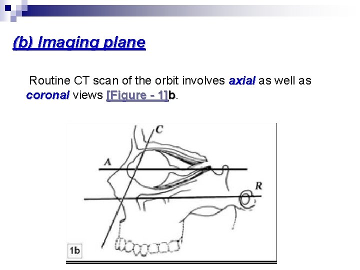 (b) Imaging plane Routine CT scan of the orbit involves axial as well as