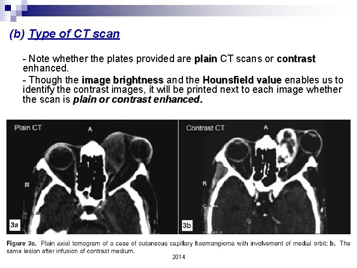 (b) Type of CT scan - Note whether the plates provided are plain CT