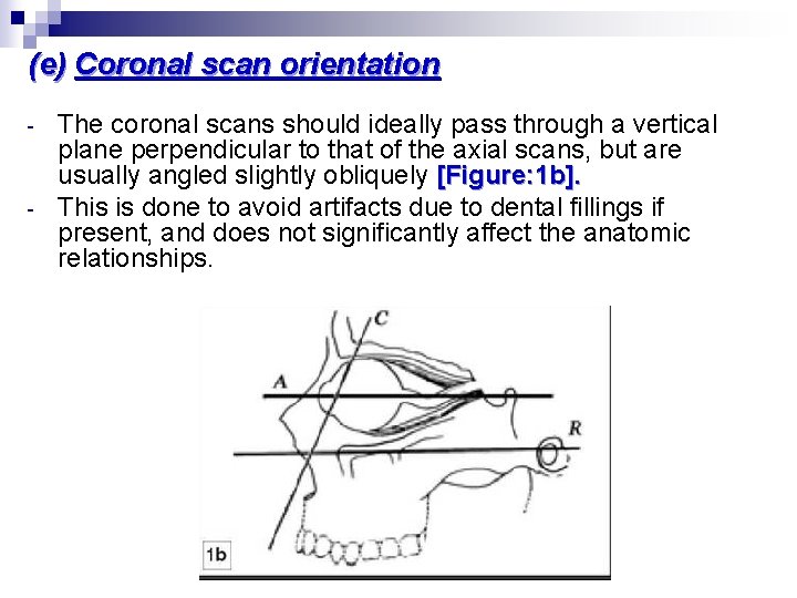 (e) Coronal scan orientation - - The coronal scans should ideally pass through a