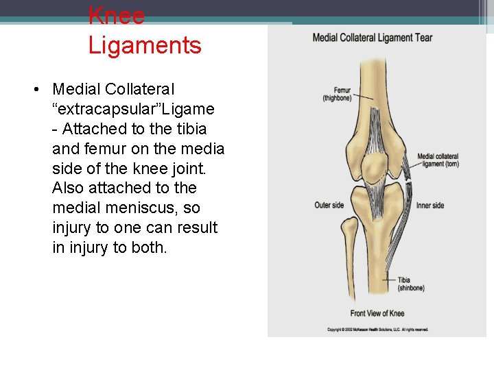 Knee Ligaments • Medial Collateral “extracapsular”Ligame - Attached to the tibia and femur on