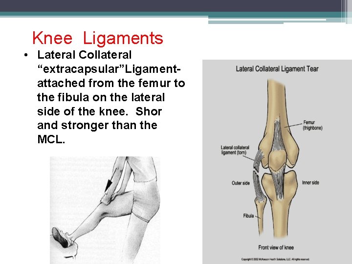 Knee Ligaments • Lateral Collateral “extracapsular”Ligamentattached from the femur to the fibula on the