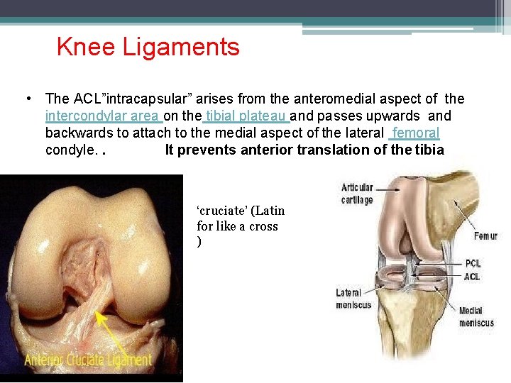Knee Ligaments • The ACL”intracapsular” arises from the anteromedial aspect of the intercondylar area
