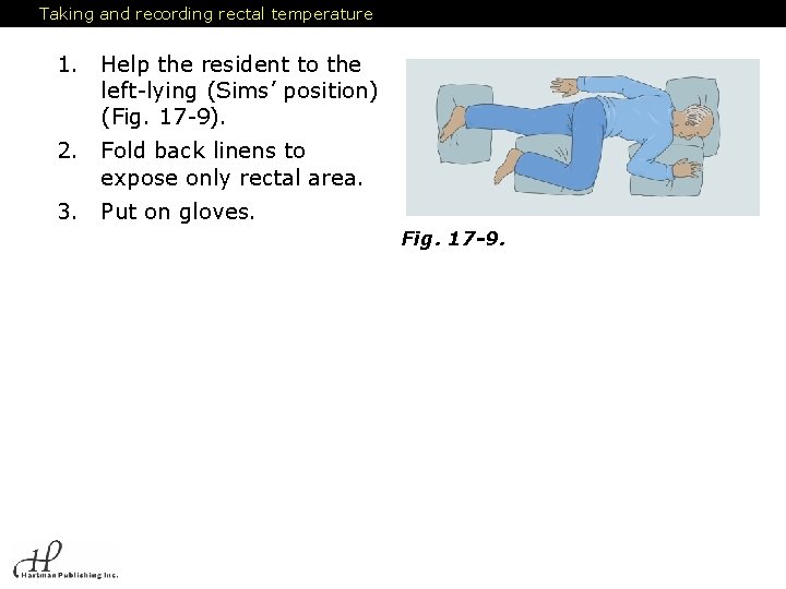 Taking and recording rectal temperature 1. Help the resident to the left-lying (Sims’ position)
