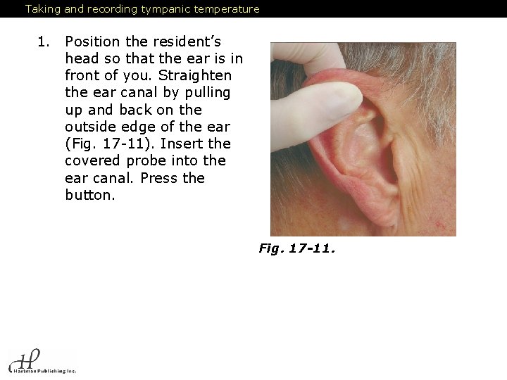 Taking and recording tympanic temperature 1. Position the resident’s head so that the ear