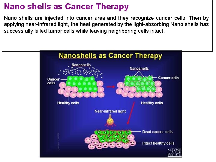 Nano shells as Cancer Therapy Nano shells are injected into cancer area and they