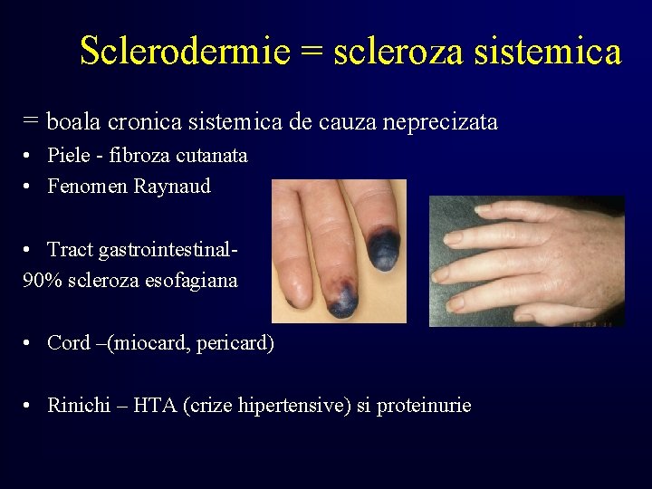 Sclerodermie = scleroza sistemica = boala cronica sistemica de cauza neprecizata • Piele -
