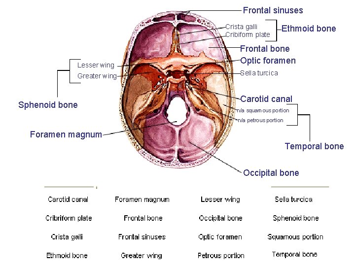 Frontal sinuses Crista galli Cribiform plate Lesser wing Greater wing Sphenoid bone Ethmoid bone