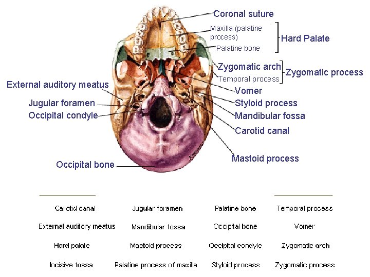 Coronal suture Maxilla (palatine process) Hard Palate Palatine bone Zygomatic arch External auditory meatus