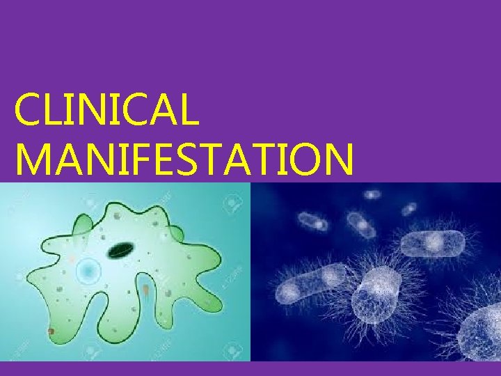 CLINICAL MANIFESTATION 