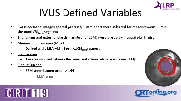 IVUS Defined Variables • • • Cross-sectional images spaced precisely 1 mm apart were