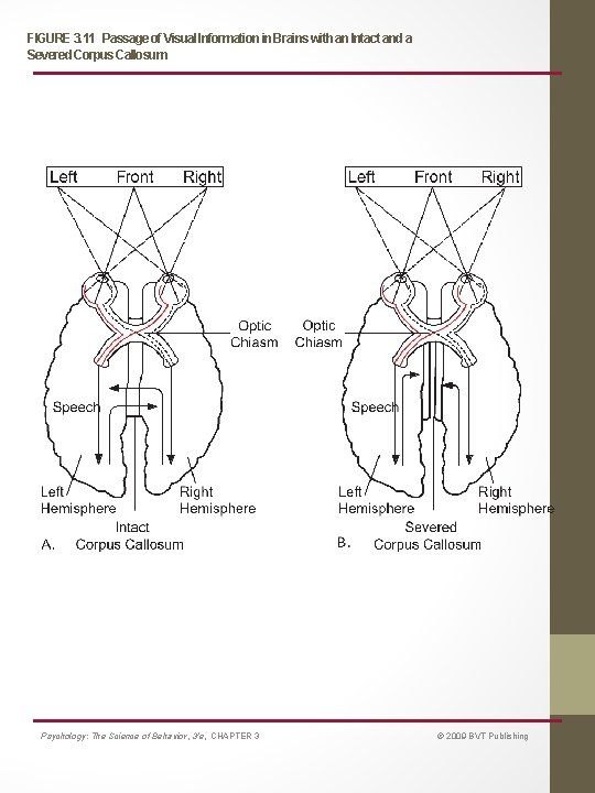 FIGURE 3. 11 Passage of Visual Information in Brains with an Intact and a