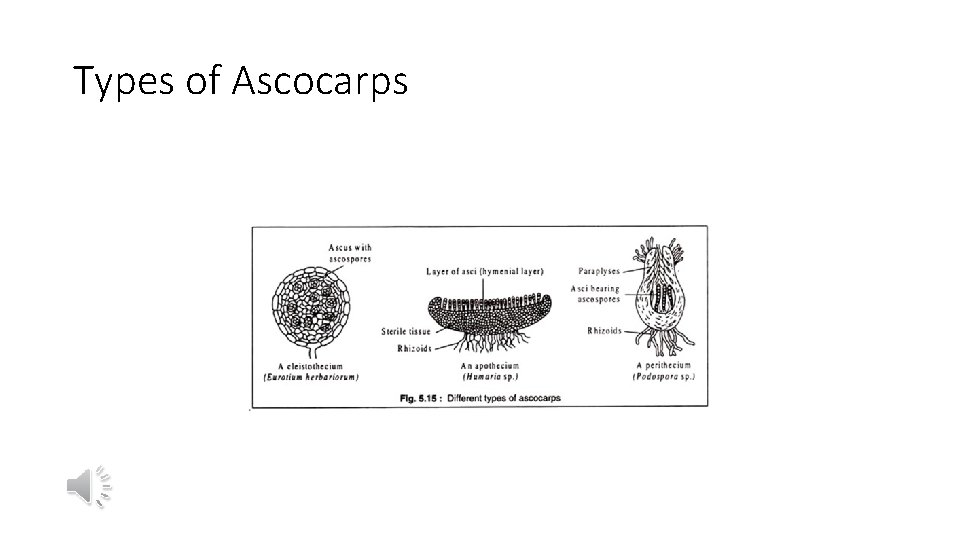 Types of Ascocarps 