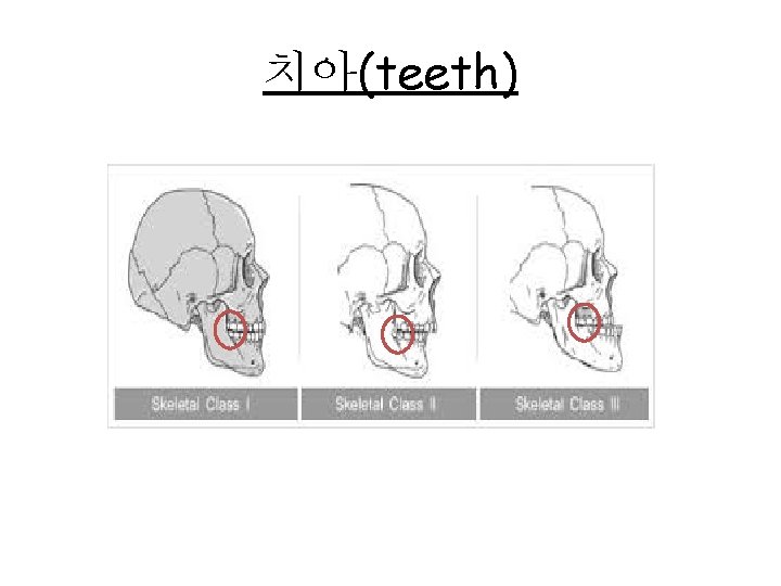 치아(teeth) 