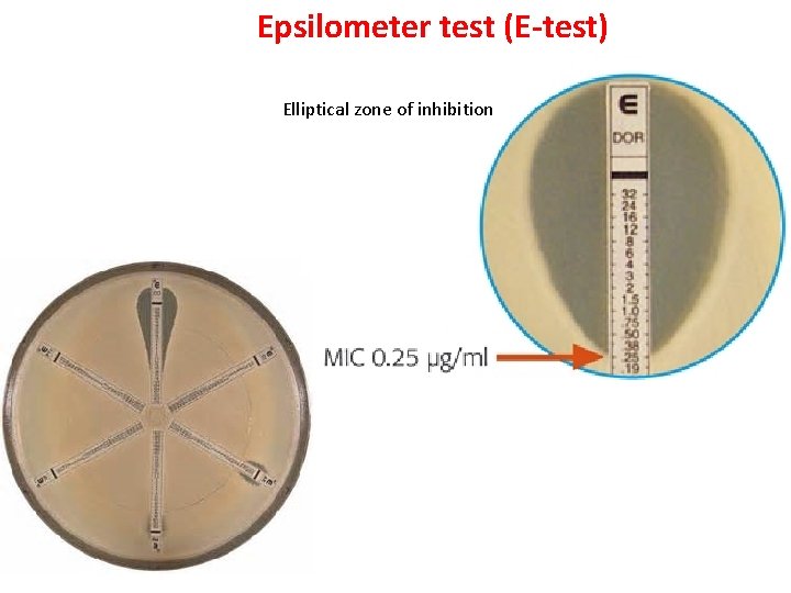 Epsilometer test (E-test) Elliptical zone of inhibition 