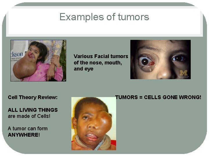 Examples of tumors Various Facial tumors of the nose, mouth, and eye Cell Theory