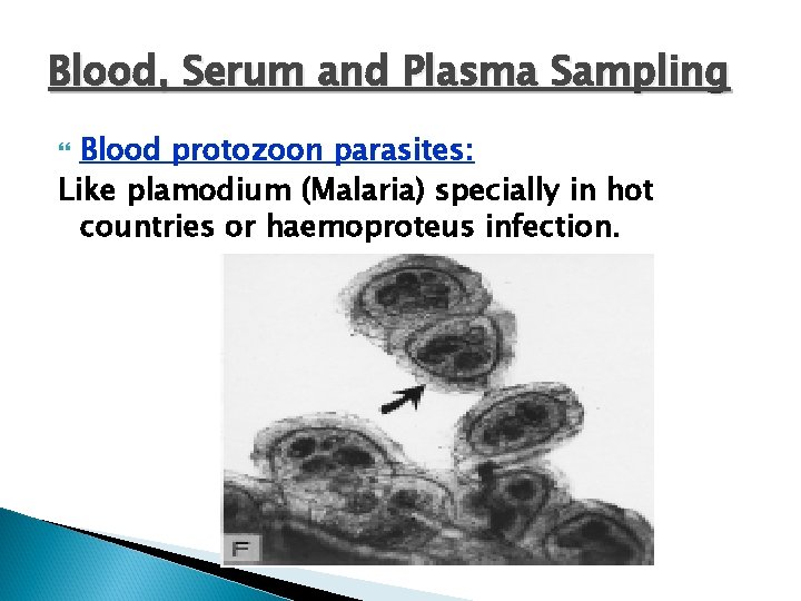Blood, Serum and Plasma Sampling Blood protozoon parasites: Like plamodium (Malaria) specially in hot