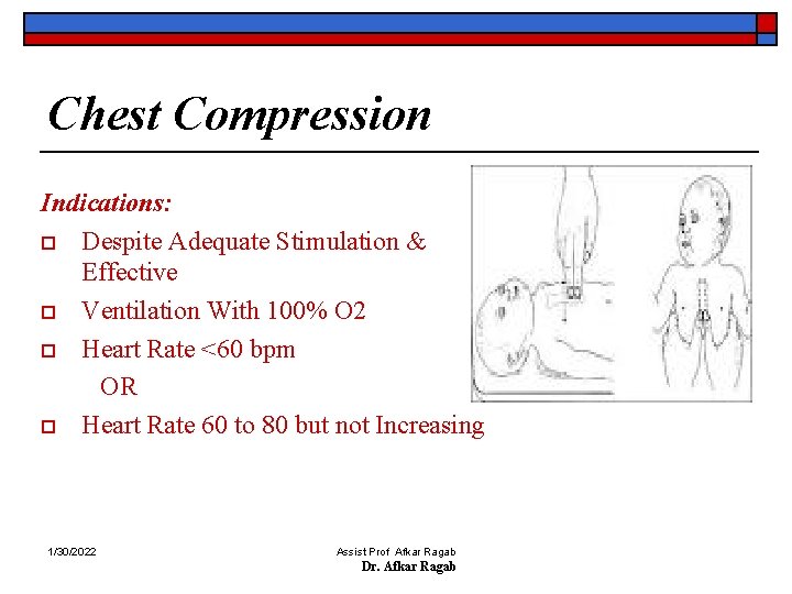 Chest Compression Indications: o Despite Adequate Stimulation & Effective o Ventilation With 100% O